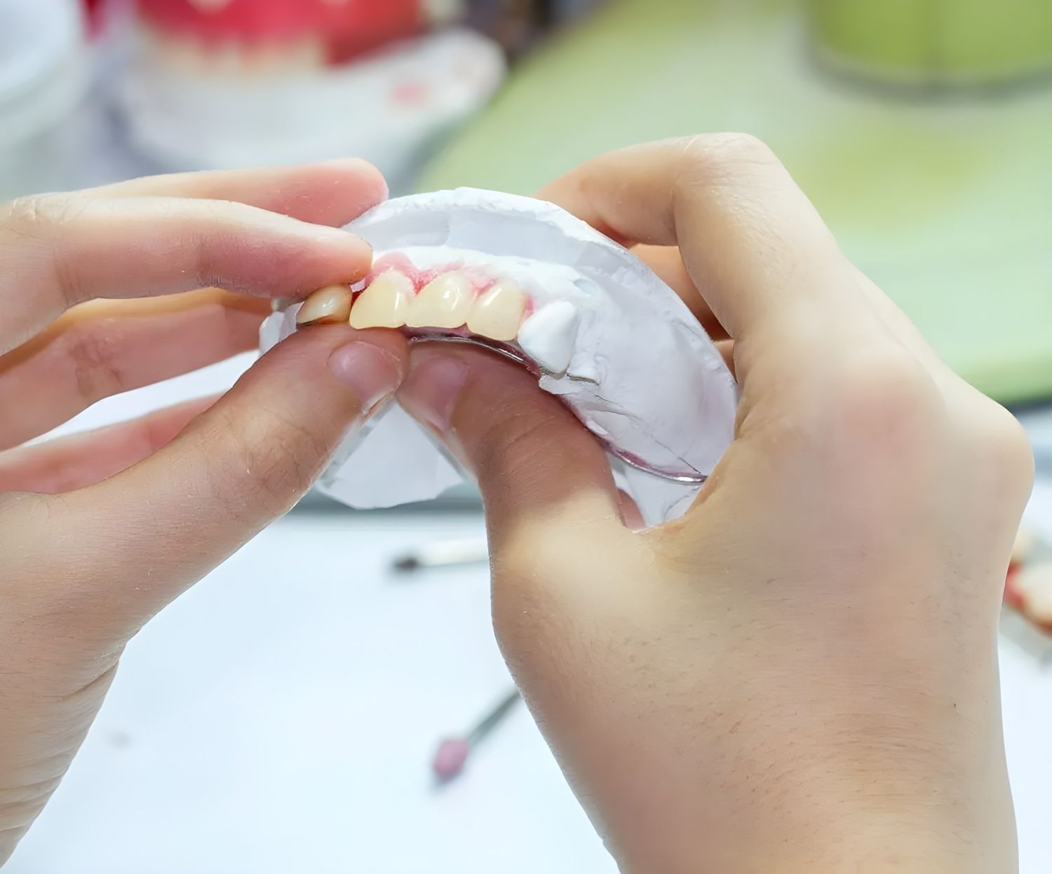 A Person is Holding a Model of Teeth in Their Hands — Jaw Gear Dental Prosthetics in Bowral, NSW