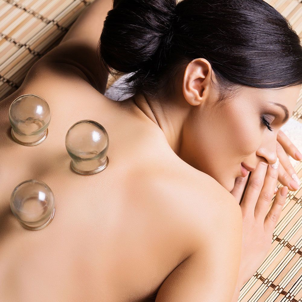 Cupping Therapy on Woman's Back