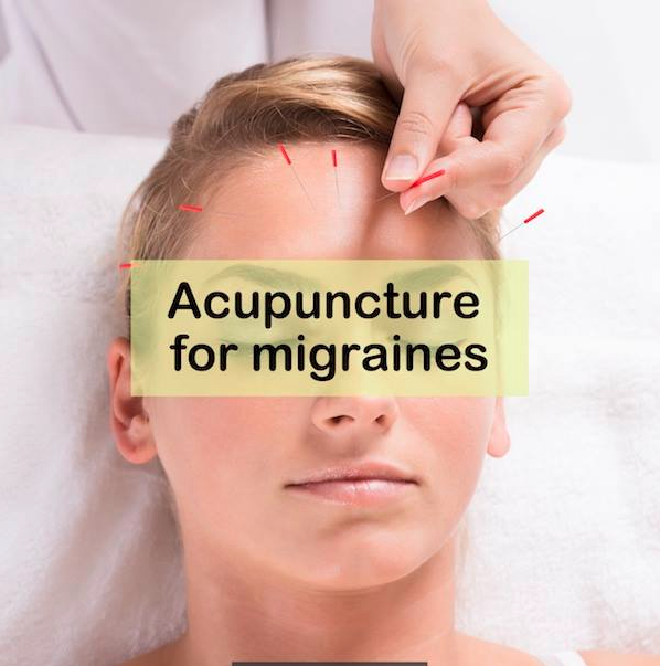 How Long Do Benefits From Acupuncture Last?
