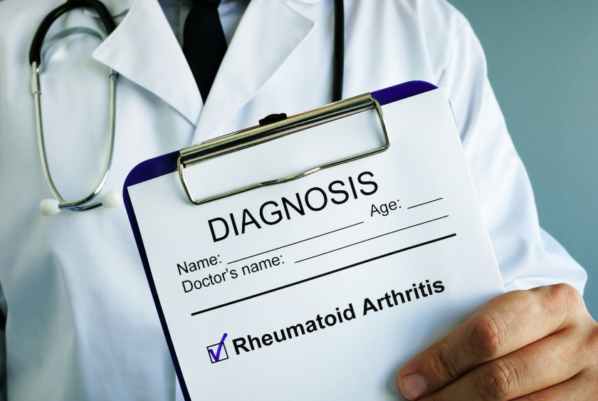 picture of a doctor holding a sign of diagnosis stating Rheumatoid Arthritis