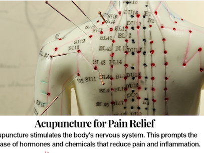 acupuncture for pain relief