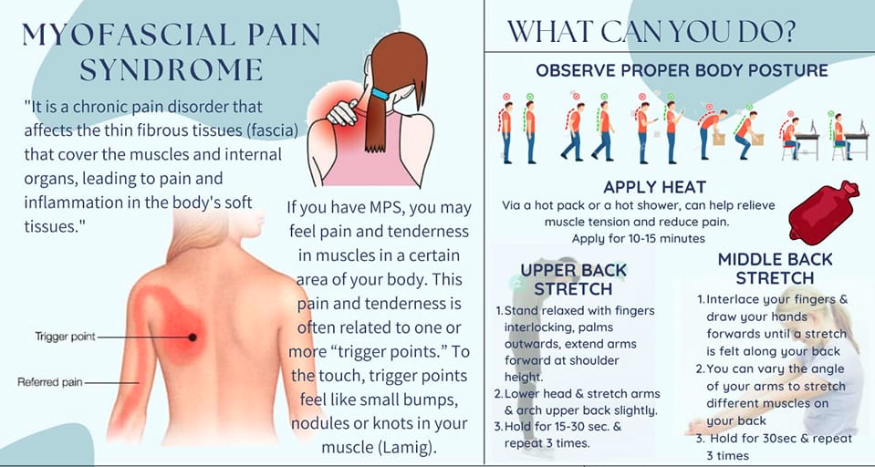 infographic about myofascial pain syndrome