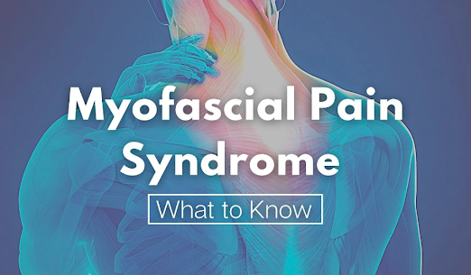 myofascial pain syndrome infographic