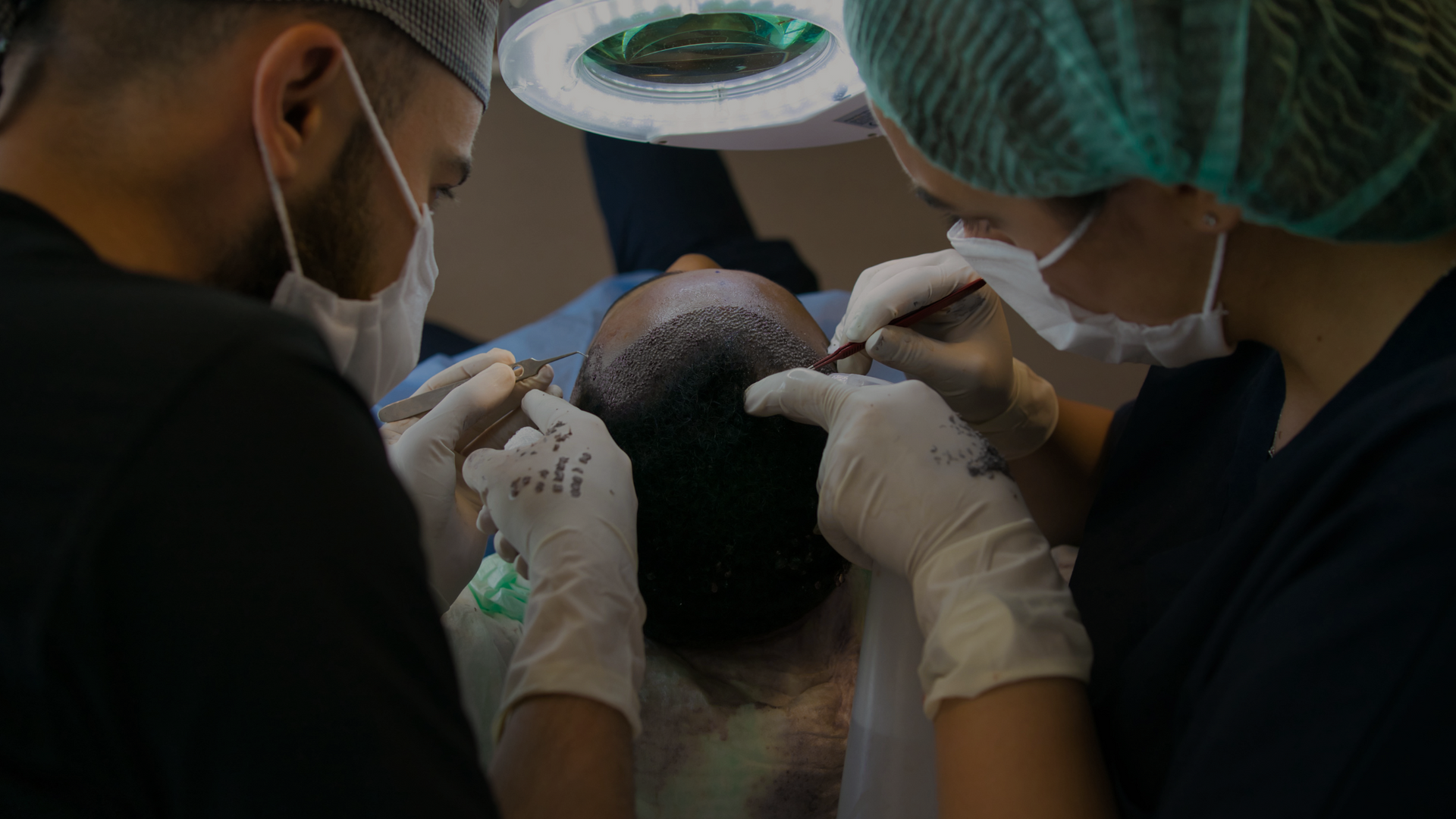 Two medical professionals performing hair transplant surgery on a patient, under bright lights.