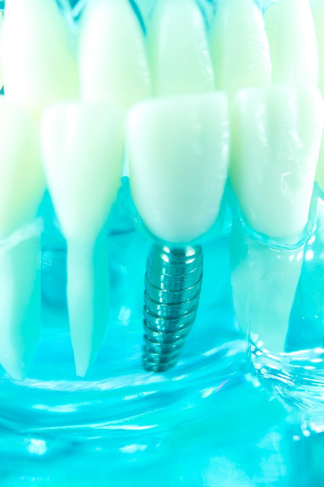 Dental Specialists Marlton and Linwood NJ