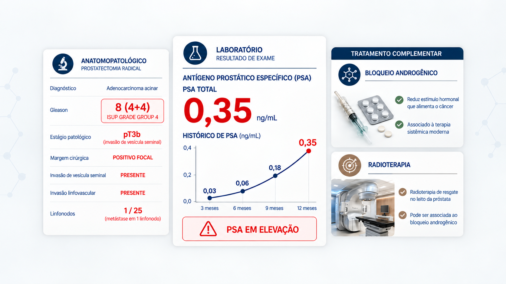 PSA elevado após prostatectomia com Gleason 8, pT3b, pN1, indicado radioterapia e bloqueio hormonal.