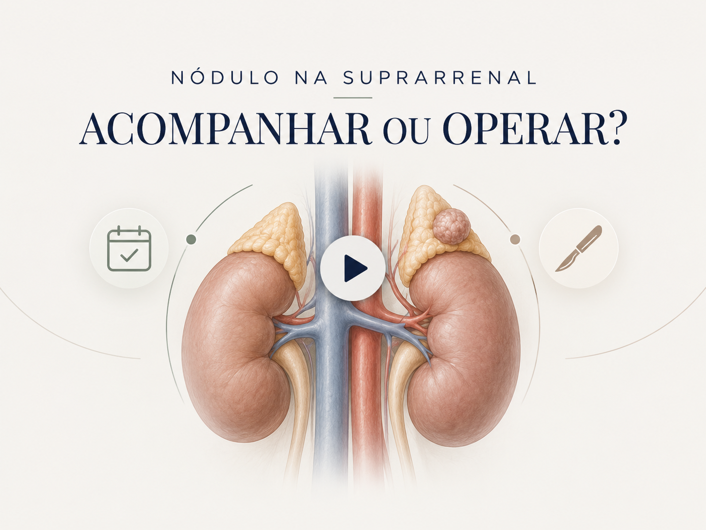 Ilustração dos rins com nódulo suprarrenal e texto “Acompanhar ou operar?”