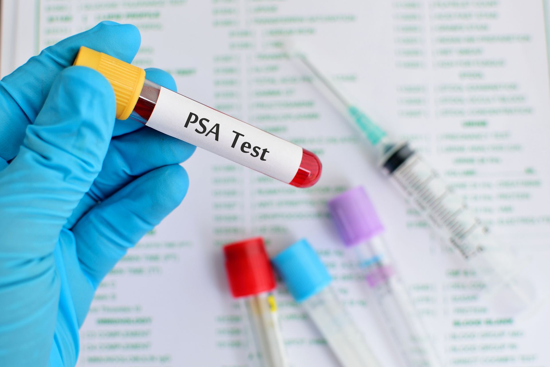 Mão enluvada segurando um tubo de coleta de sangue com a etiqueta “Teste de PSA”