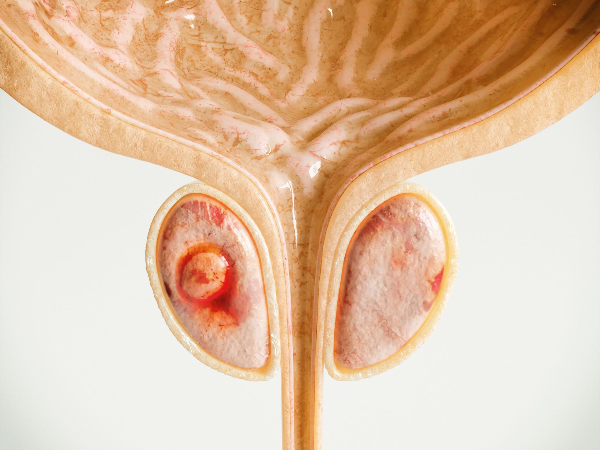 Anatomia do sistema urinário humano mostrando a bexiga, os ureteres e os rins em uma ilustração médica.