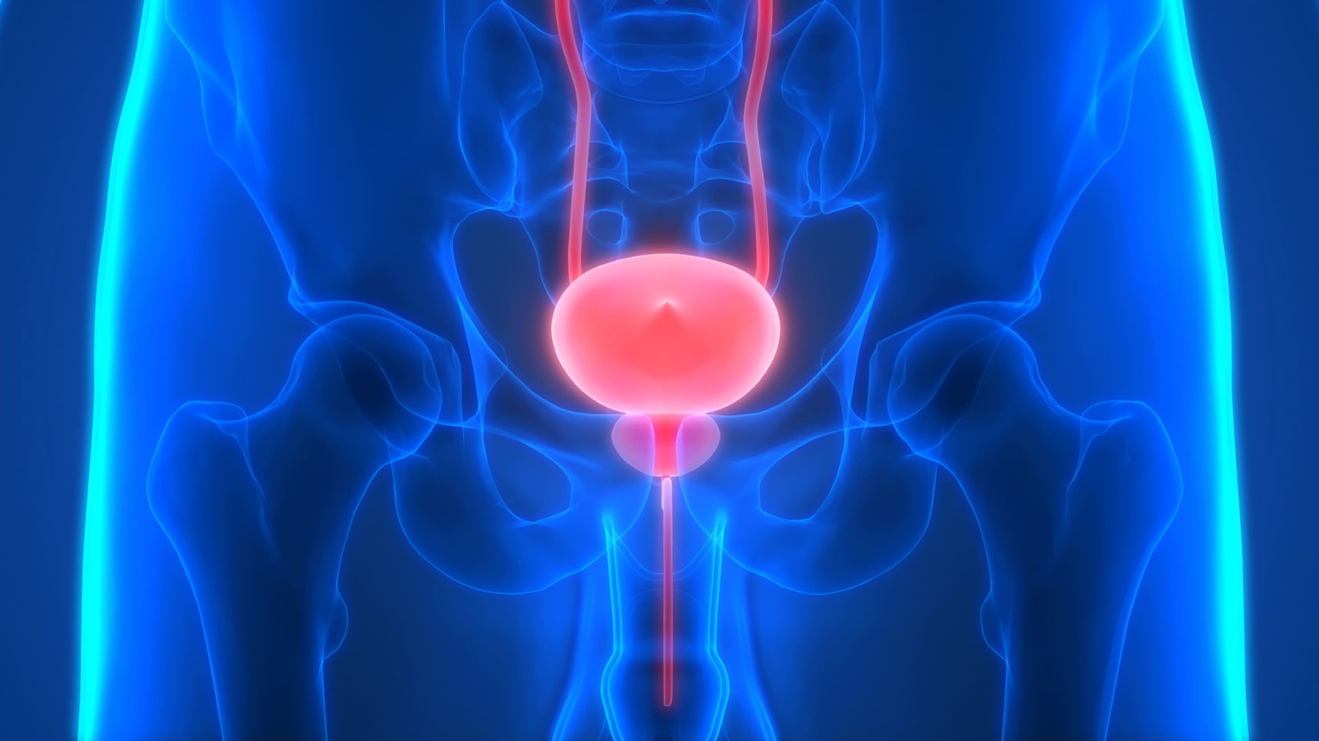 Ilustração da pélvis em tons de azul com uma bexiga urinária vermelha brilhante destacada ao centro.