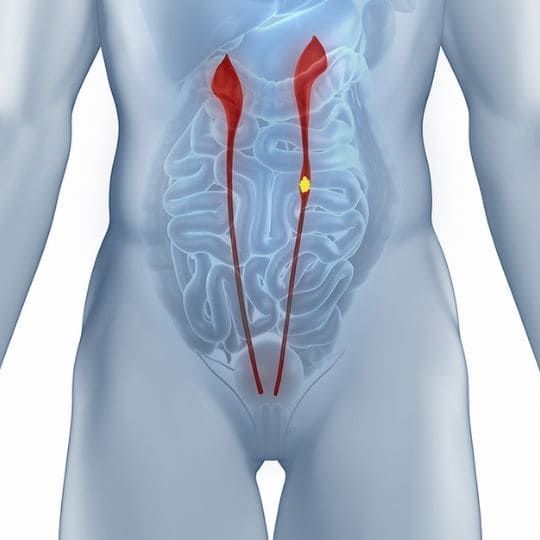 Diagrama do torso humano mostrando os rins e o trato urinário destacados em vermelho e amarelo.