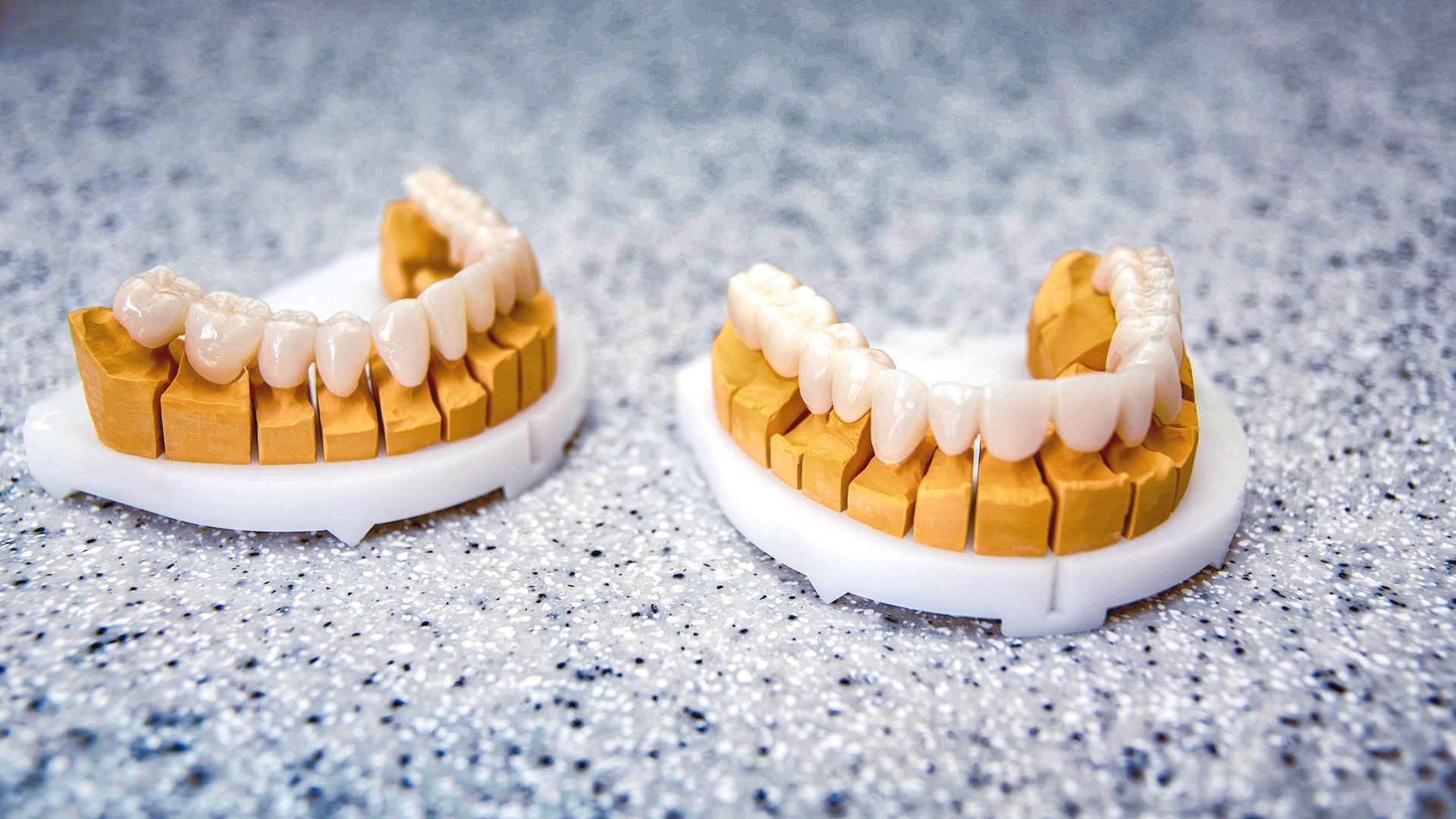 Due modelli di protesi dentale con denti bianchi su una superficie grigia punteggiata