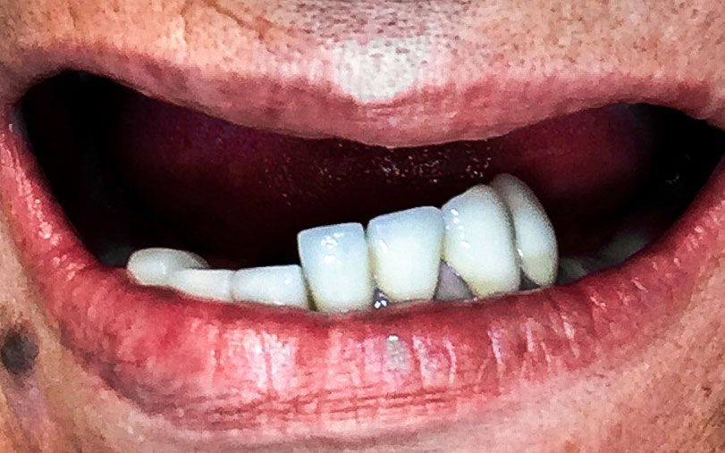 Primo piano di una bocca sorridente che mostra denti bianchi e labbra rosa