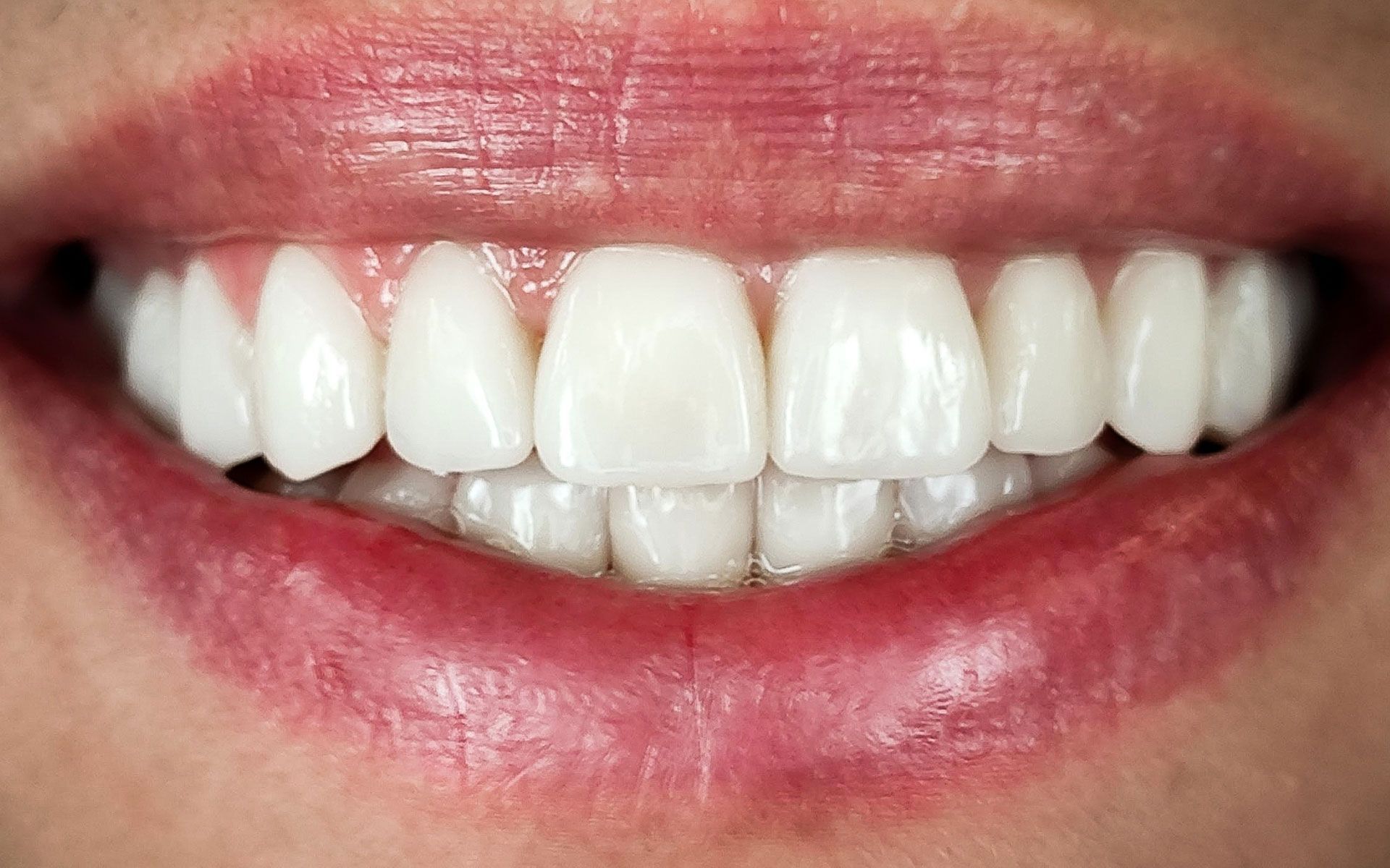 Primo piano di una bocca sorridente con denti bianchi e labbra rosa