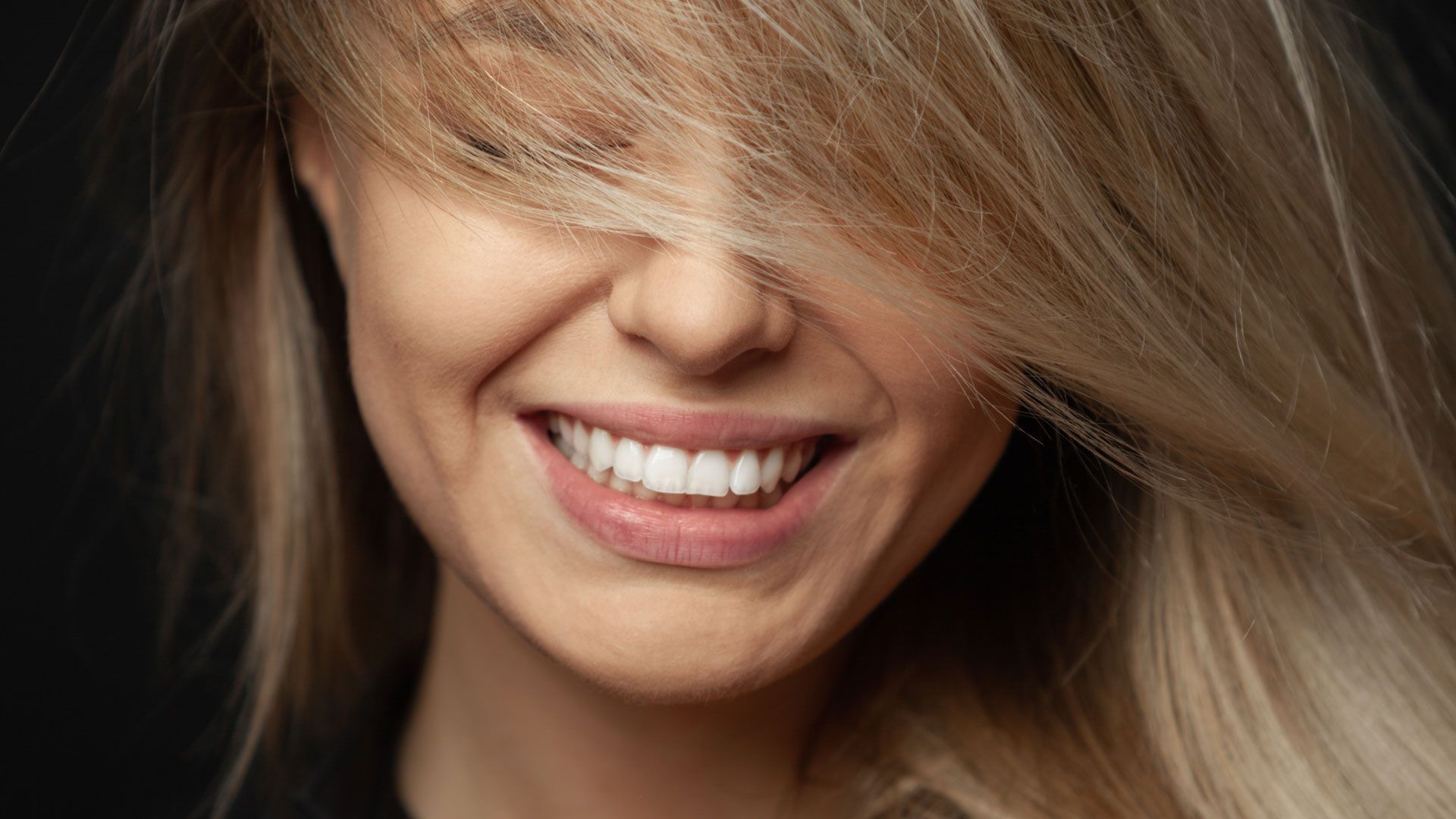 quanto durano le faccette dentali