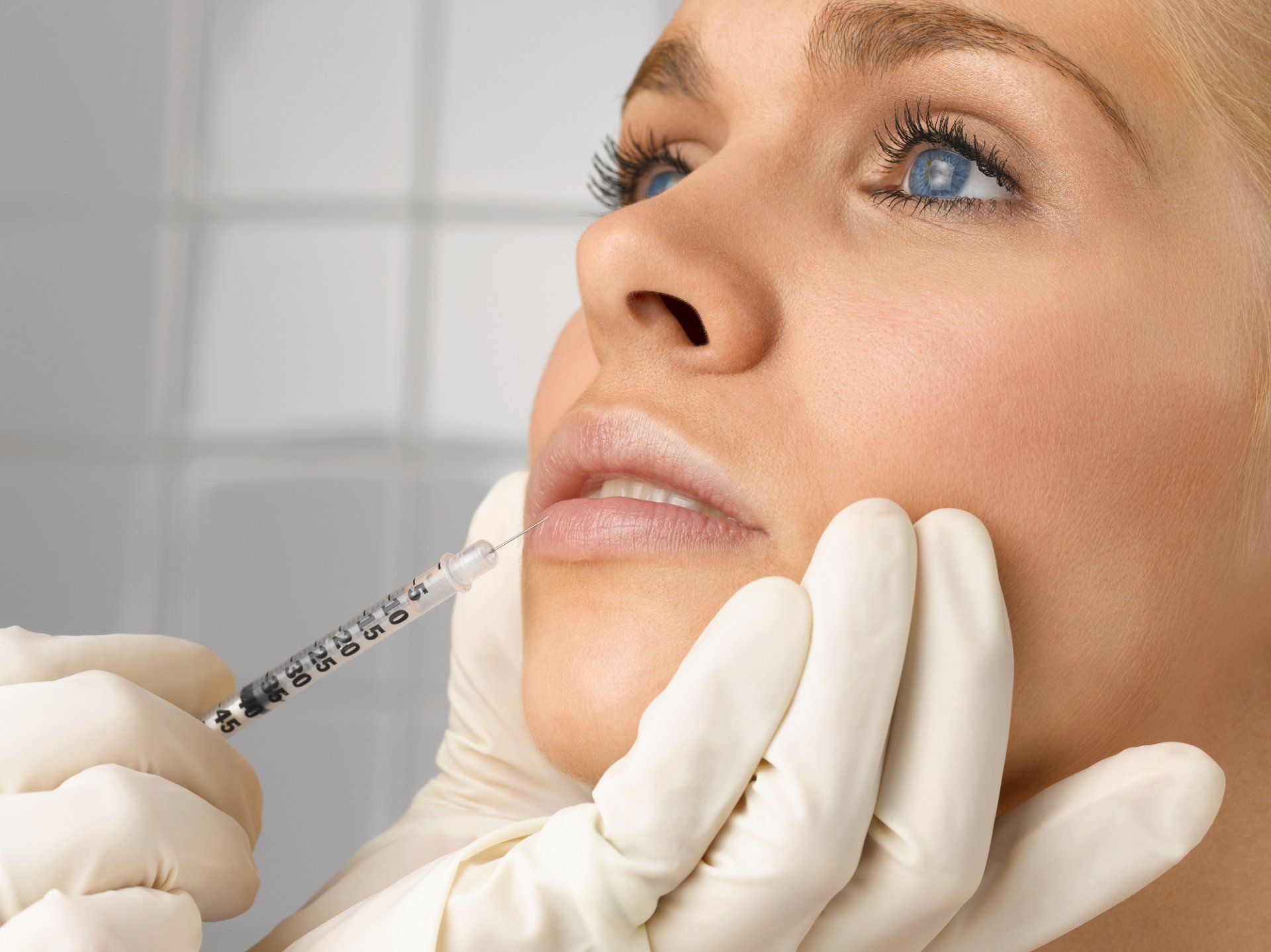 FILLER VISO E LABBRA