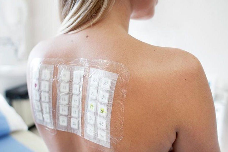 PATCH TEST