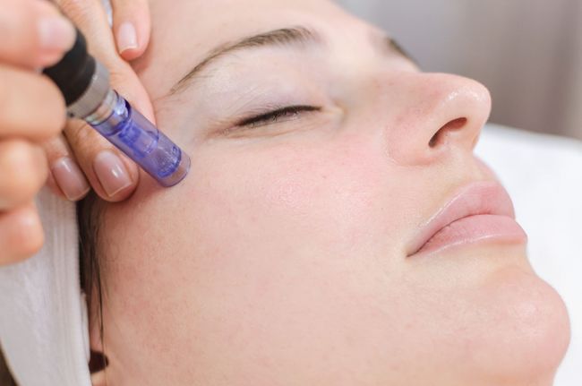 Microneedling device treating a woman’s cheek with purple serum