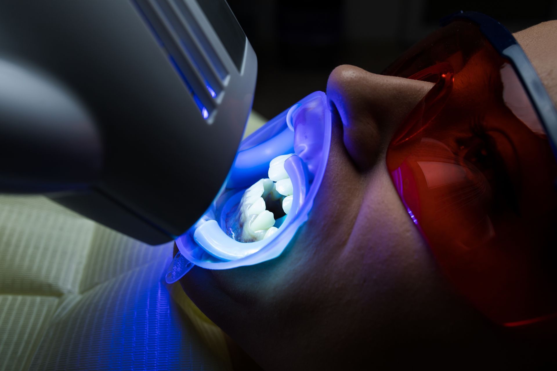 Dental light curing a person's teeth during treatment, with blue light and red protective glasses Dental light curing a person's teeth during treatment, with blue light and red protective glasses