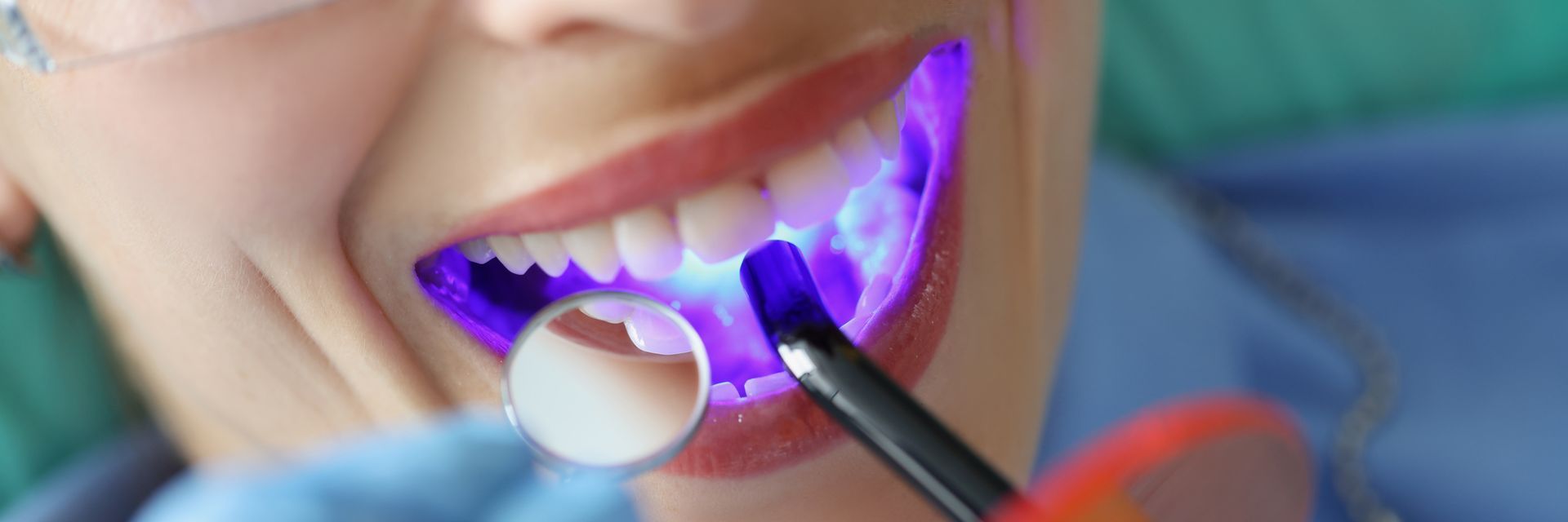 Close-up of a dentist’s tool and mirror examining glowing blue-lit teeth Close-up of a dentist’s tool and mirror examining glowing blue-lit teeth