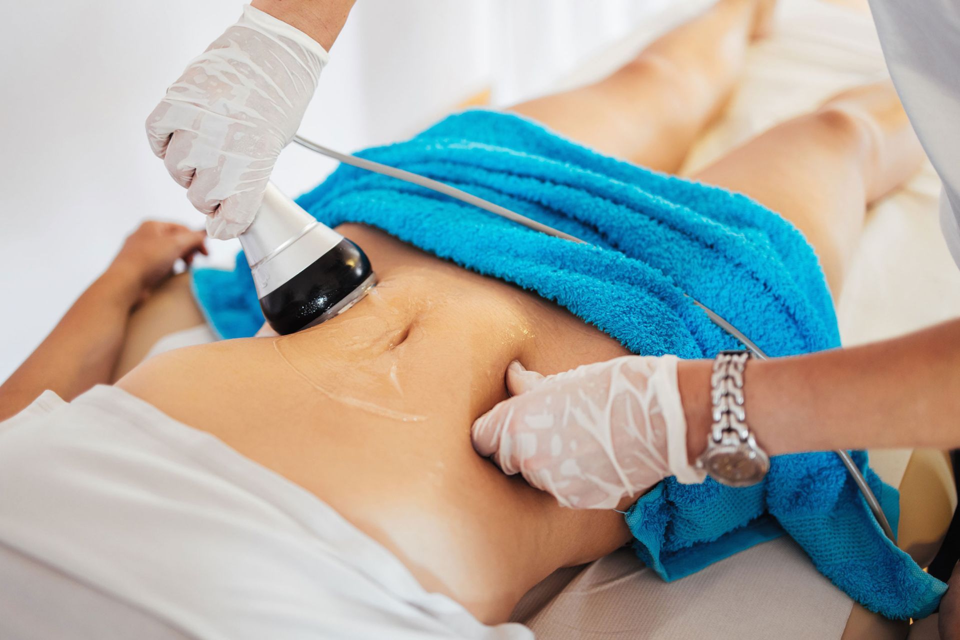 A person receiving radio frequency treatment on their abdomen; blue towel, white gloves, close-up shot. A person receiving radio frequency treatment on their abdomen; blue towel, white gloves, close-up shot.