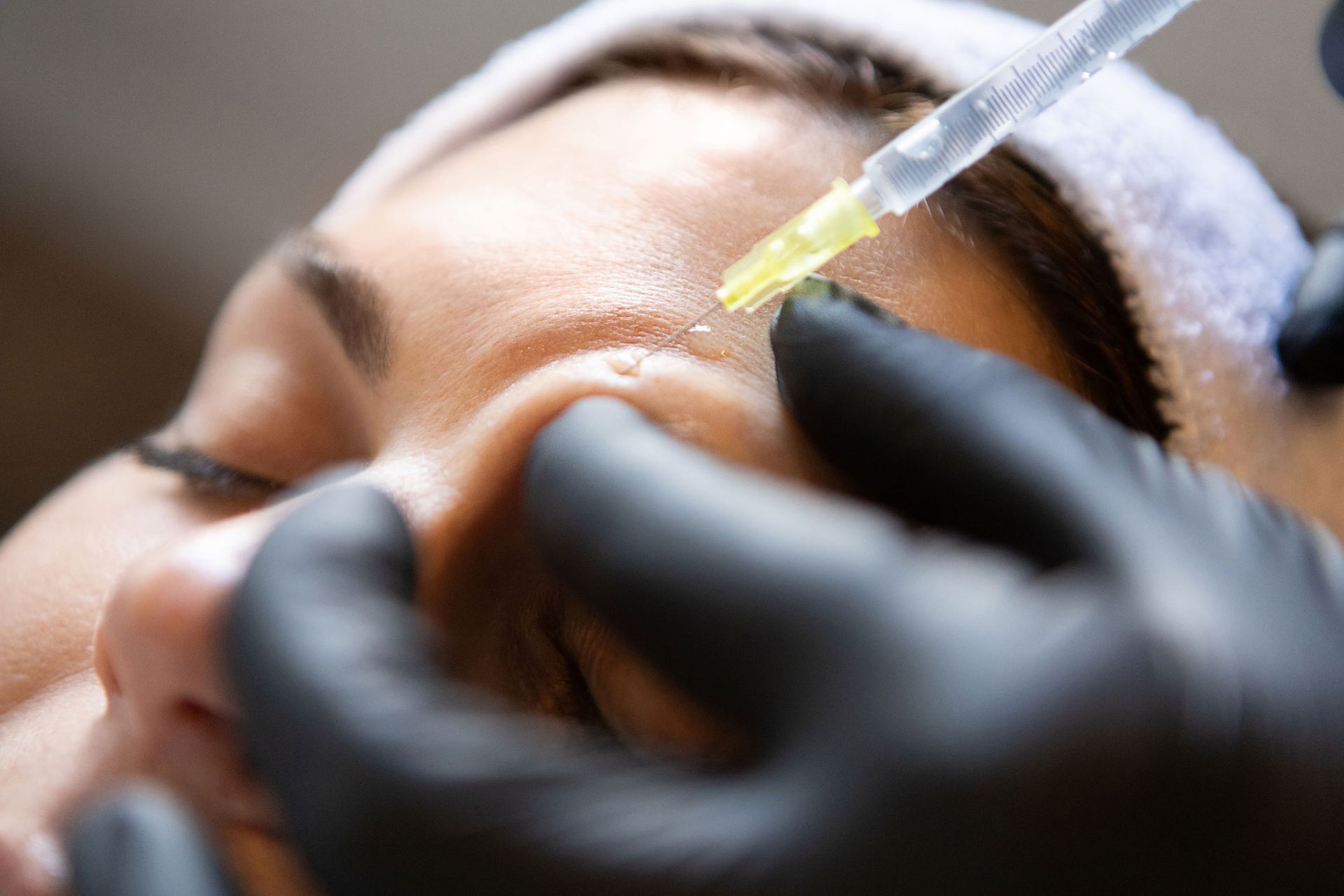 Close-up of a person receiving a forehead injection with a syringe. Close-up of a person receiving a forehead injection with a syringe.