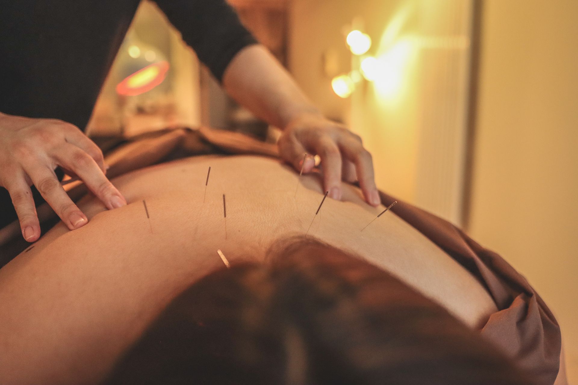 Acupuncture – Minnetonka, MN - Lake Minnetonka Mobile Wellness