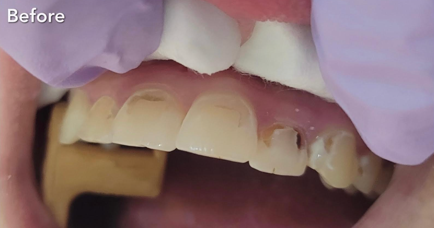 A close up of a person 's mouth with a smile on it.