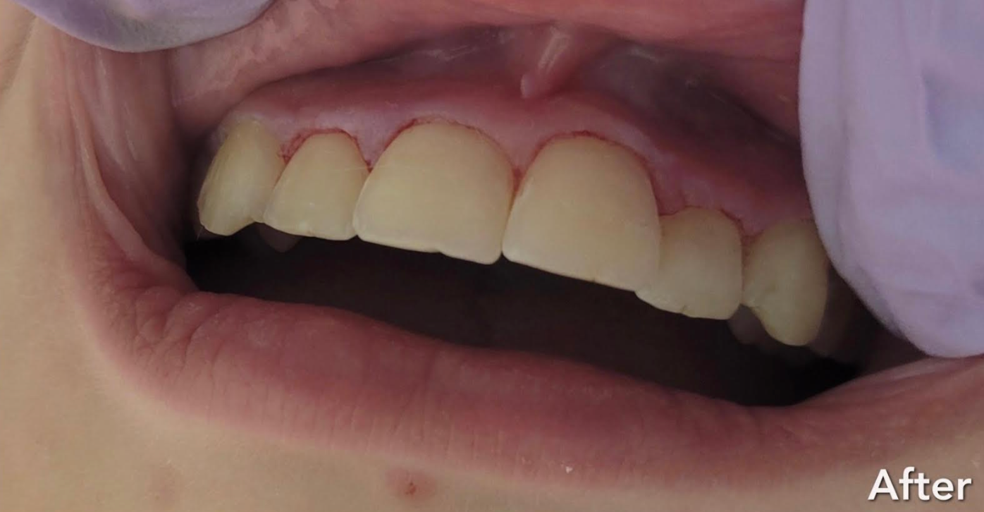 A man with a beard and white teeth is smiling.