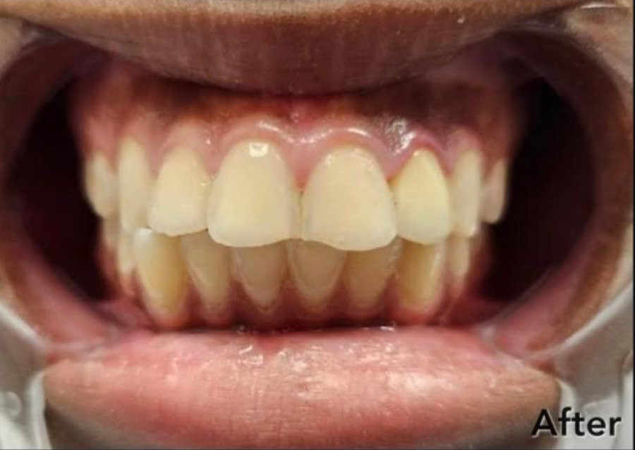 A close up of a woman 's smile with white teeth and red lips.