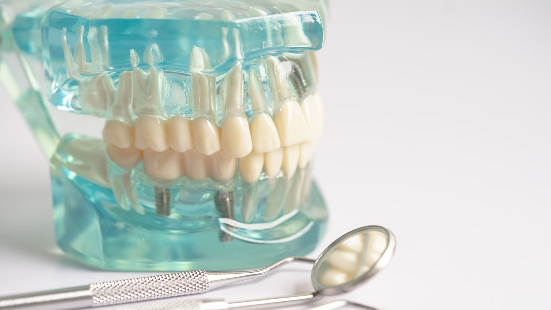 Dental model with tools, including a mirror and dental probe, on a white surface.