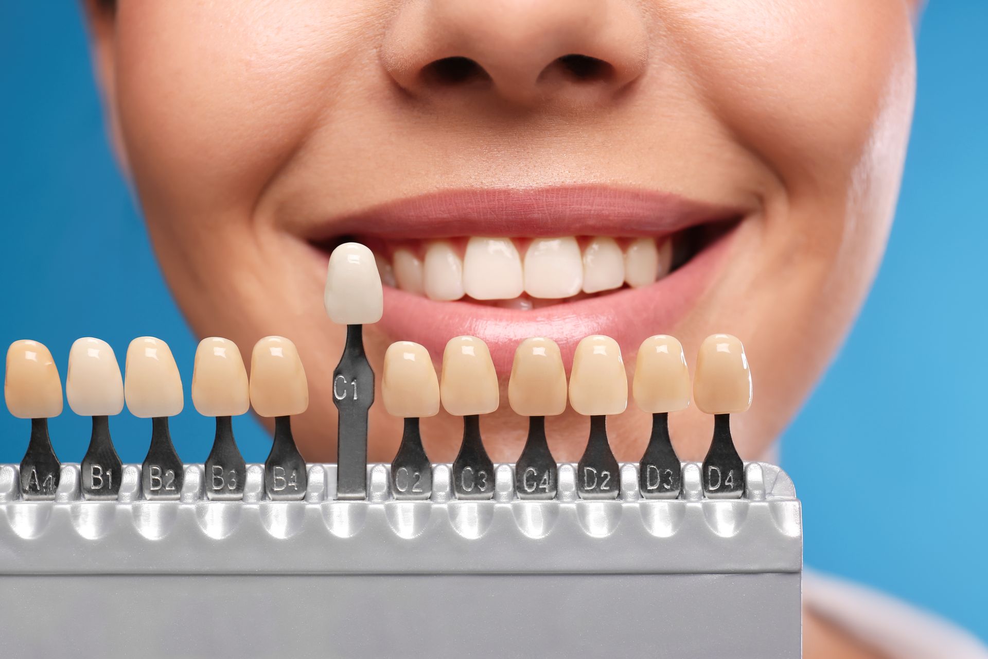 Woman with bright smile comparing teeth to shade guide for whitening.