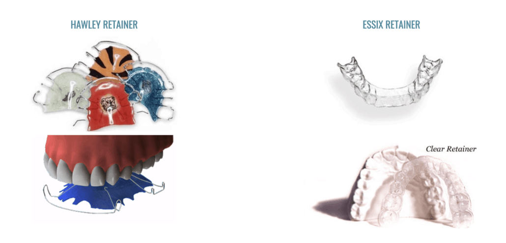 replacement retainer replacement retainer