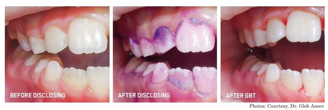 Pannal Dental Clinic - hygiene airflow, dental treatments