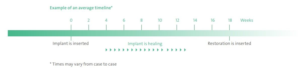 Pannal Dental Clinic, dental implants in Harrogate