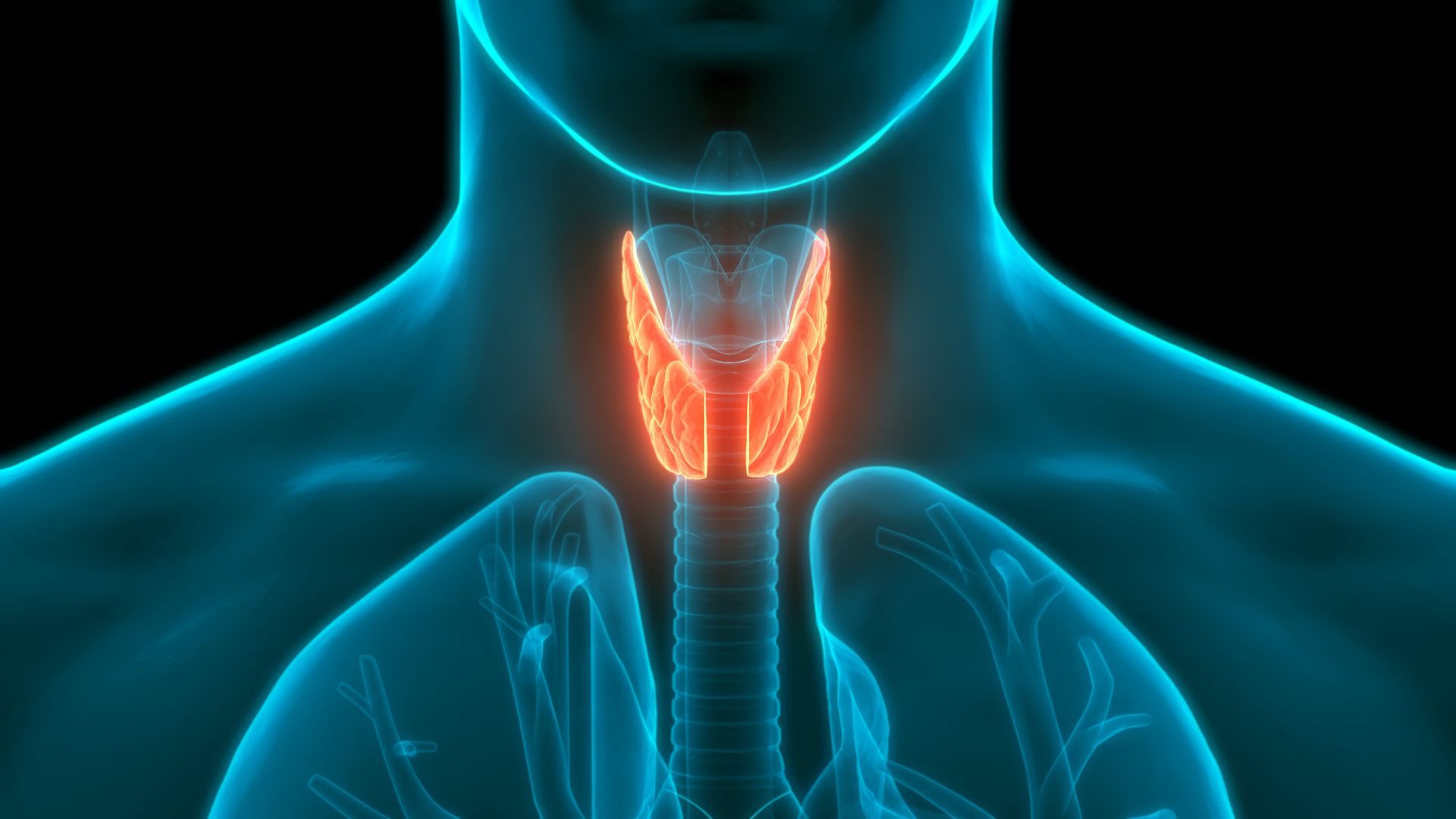 Como funciona a iodoterapia para tireoide Como funciona a iodoterapia para tireoide