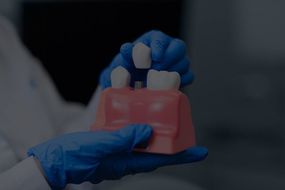 Dentist Holding Model of Teeth — Dentistry Services in Cairns, QLD