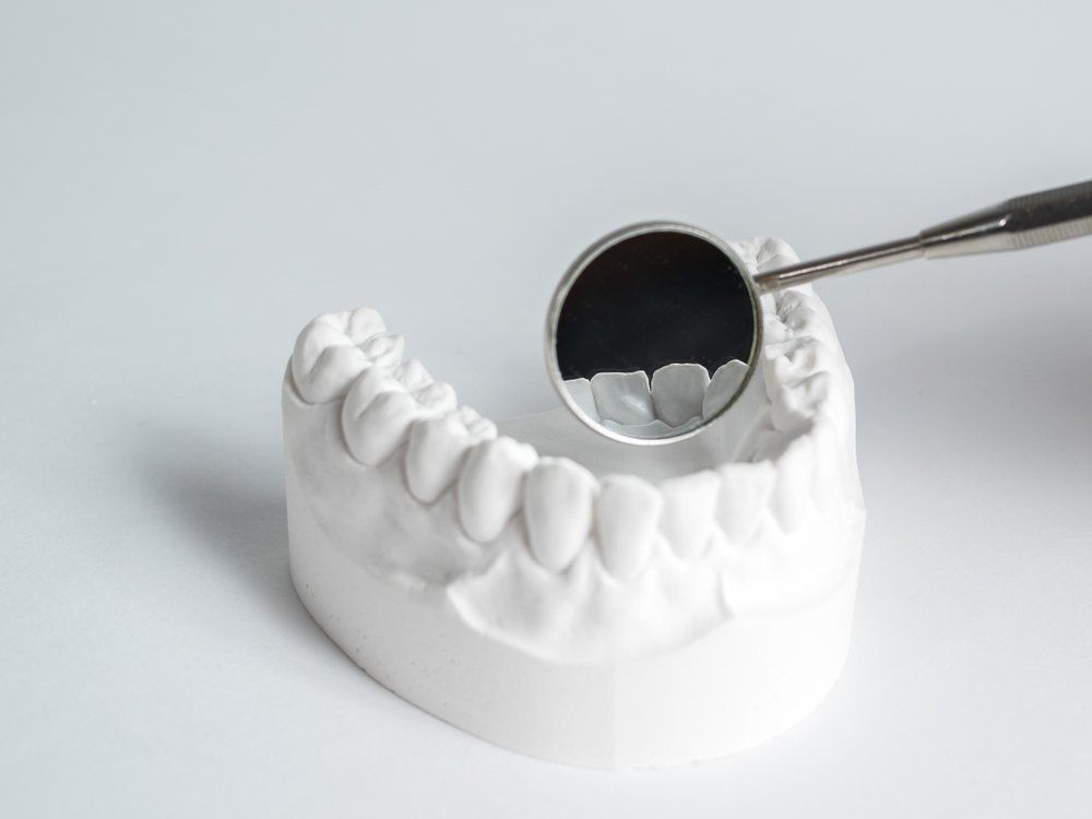 Examining Clay Tooth Mould — Dentistry Services in Cairns, QLD
