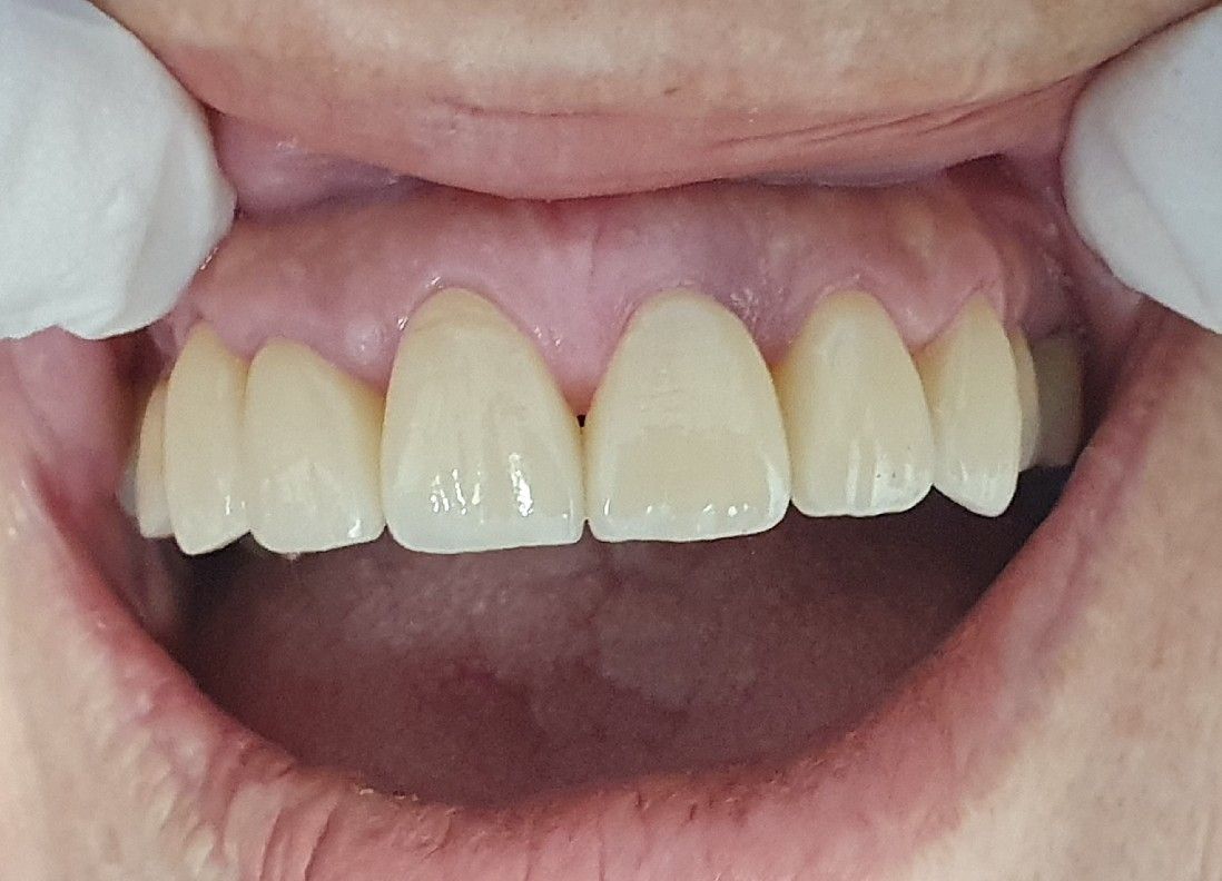 Dental After - The Dentist Cairns Dental Group