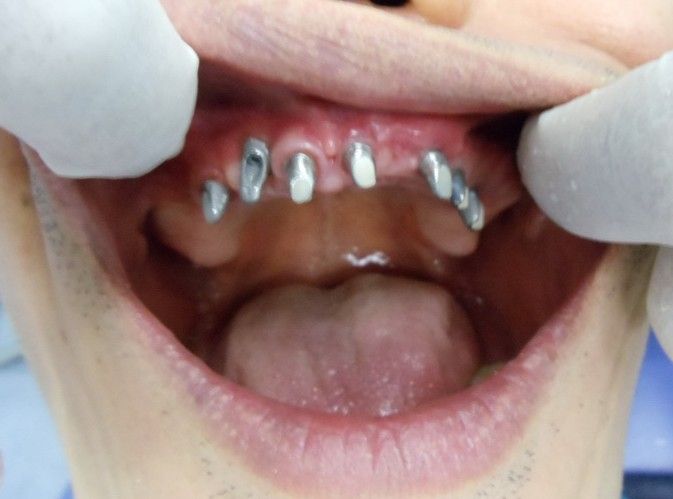 before-the-procedure