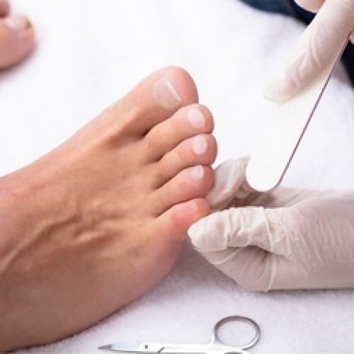 Eine Person lässt sich die Füße maniküren. Eine behandschuhte Hand feilt die Zehennägel; eine Schere liegt daneben.