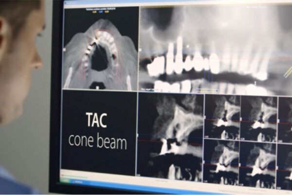 tac cone beam