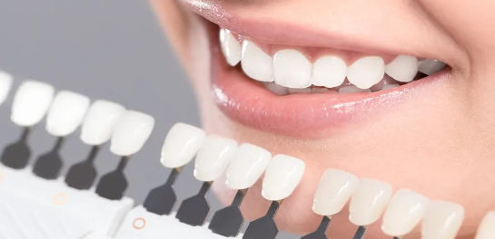 Porcelain Veneers