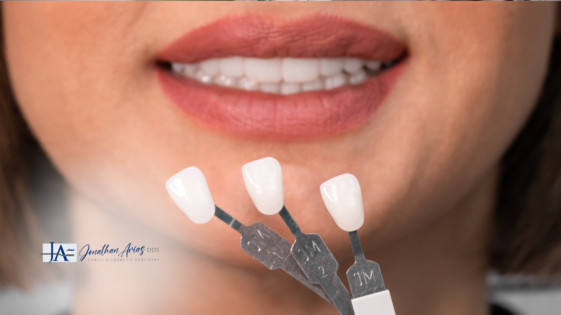 A close up of a woman 's mouth with three shades of white teeth.