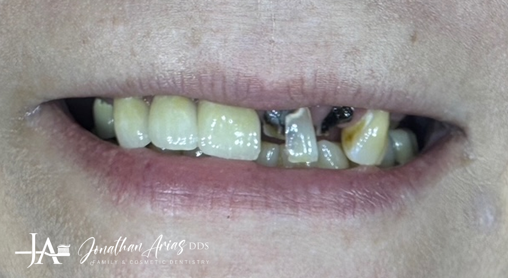 A close up of a woman 's mouth with a smile on her face.