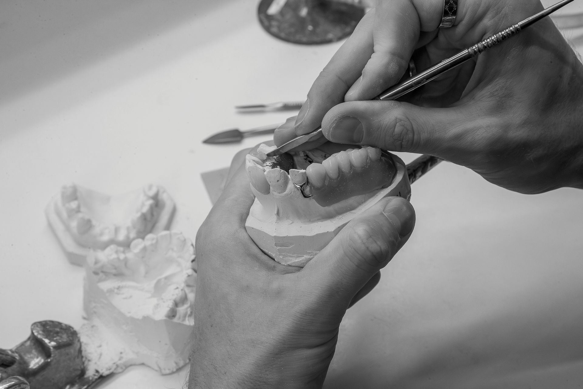 Hands Carving a Plaster Dental Model — Smiles On Hobart in Hobart, TAS