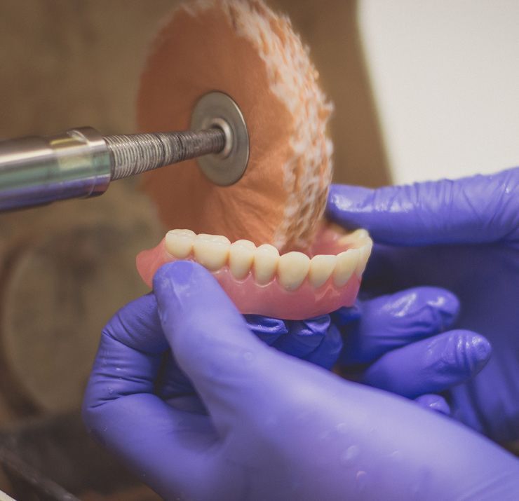 Gloved Hands Polishing a Dental Prosthetic With a Rotary Tool — Smiles On Hobart in Sandy Bay, TAS