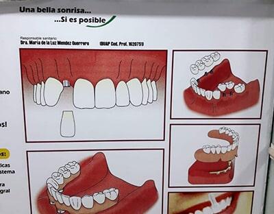 COSMÉTICA DENTAL - REHABILITACIÓN INTEGRAL ESTÉTICA COSMÉTICA DENTAL - REHABILITACIÓN INTEGRAL ESTÉTICA