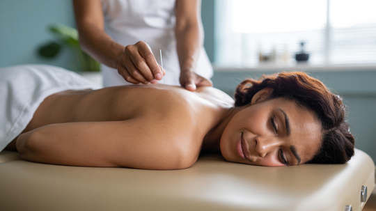 Woman receiving acupuncture on her back, smiling, on a massage table in a spa-like room.