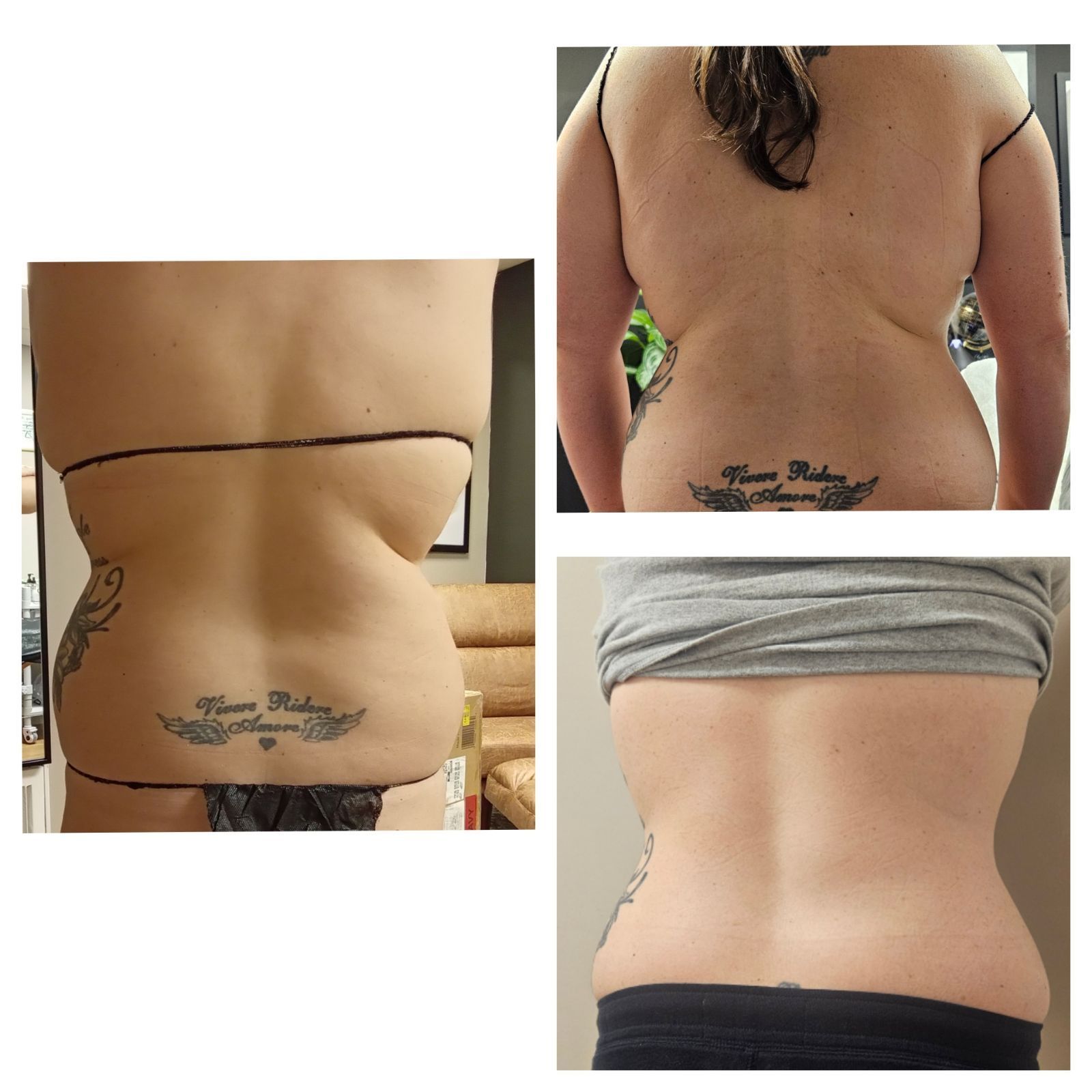 A woman with a tattoo on her back is shown before and after losing weight